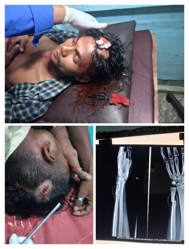 बर्दगोरियाको वडा नम्बर -५ मा गए राती कुटपिट हुँदा २ जनाको टाउकोमा चोट १ को हात भाँचियो